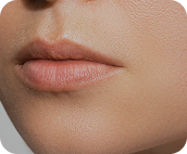 تزریق فیلر لب متد روسی - قبل از درمان